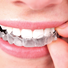 Invisalign mais Conforto para você